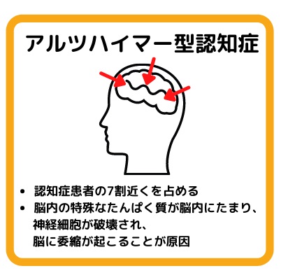 アルツハイマー型認知症