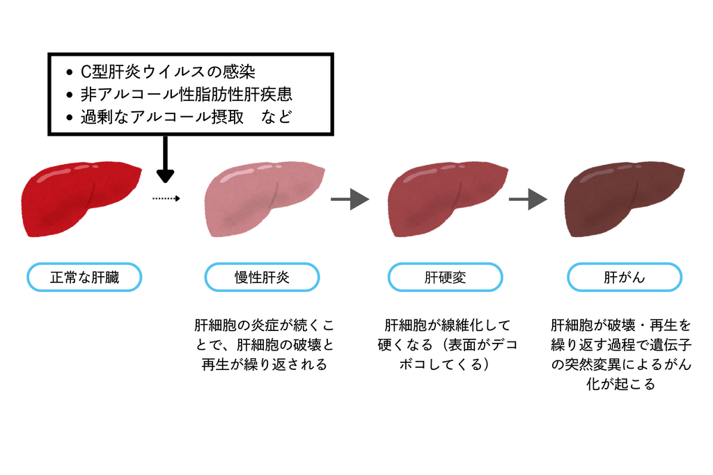 健康・医学 PrinciplesandPracticeofInfectiousDiseas HepaSign(R)肝疾患リスク検査 | 株式会社プリメディカ